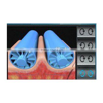 2015 Hot Sell Apparatus of Cavitation Skin Roller
