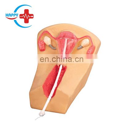 HC-S317 Advanced female intrauterine device Intrauterine contraceptive teaching model