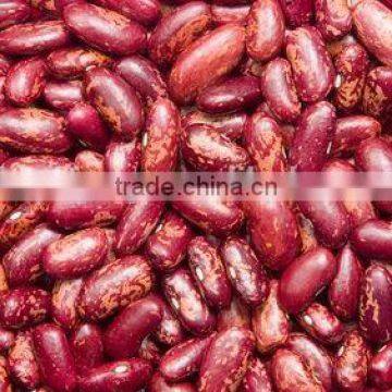 20015 New Crop British Type Dark Red Kidney Beans