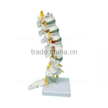 Life-size 5 Pcs Anatomical Lumbar Vertebra Model