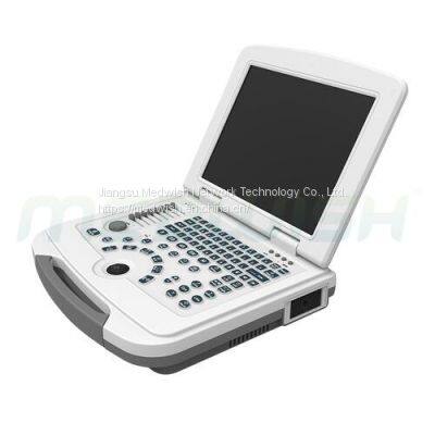 DW-500 LCD Medical Display Multiple Rate Shows Ultrasound Machine For Sale