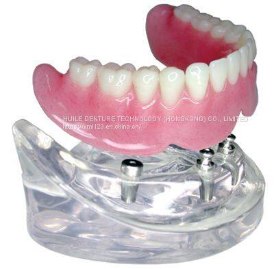 REMOVABLES | PARTIALS  CustomFlex Flexible Partial Dental Lab