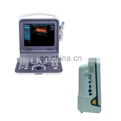 Chinese factory cheap portable color doppler ultrasound system and machine