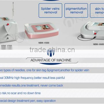 Painless and effective removal spider vein high frequency vein removal macfree