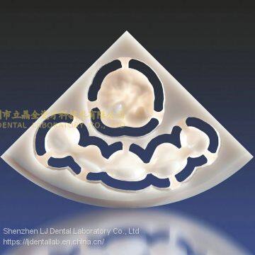 Wieland Zenostar Dental Crown, Solid Zirconia Bruxzir, Dental Teeth, Laboratoire Dentaire, Dentallabor, Laboratorio Dental, Dental Laboratory, Shenzhen LJ Dental Lab China