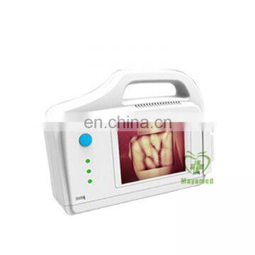 Hospital injection portable Near-Infrared vein finder Price or vein viewer For Sale