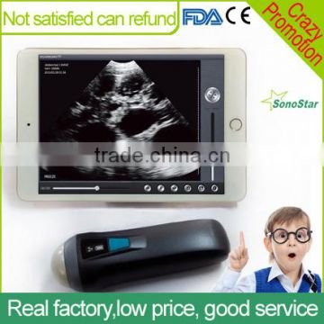 Sonostar Ipad ultrasound scanner wireless convex ultrasound Sector probe for pregnancy UProbe-1