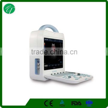 Chinese Laptop portable 3D/4D color doppler ultrasound scanner supplier DCU10