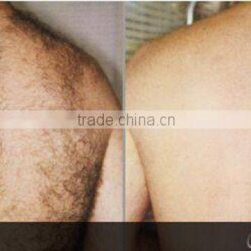 Promotion!!! Professional Spa IPL SHR Laser Hair Removal Multifuntional Machine Price photo-5