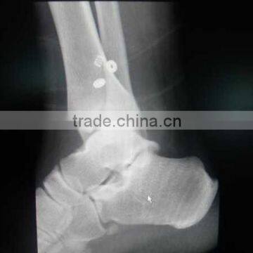 CE KND-A/F Medical Thermal x Ray Film China photo-5