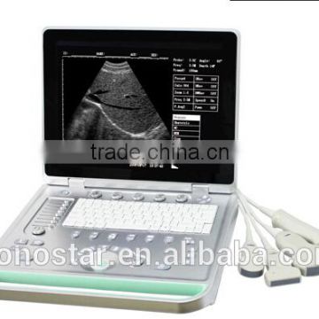 pretty laptop 2D ultrasound machine(good image, low good price device, cheapest portable)