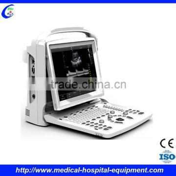 Portable Color Doppler Ultrasound System