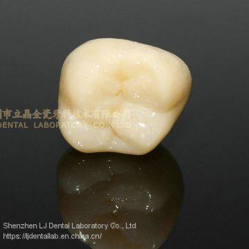Dental crown solid zirconia bruxzir, dental teeth, laboratoire dentaire, Dentallabor, laboratorio dental, dental laboratory, Shenzhen LJ dental lab China