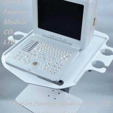 Medical Full Digital Portable Ultrasound Scanner