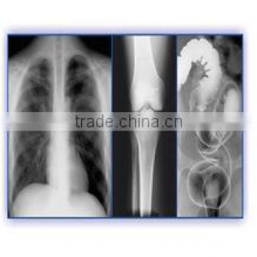 the most popular CT/CR medical dry film medical film hospital dry film x-ray film standard medical film