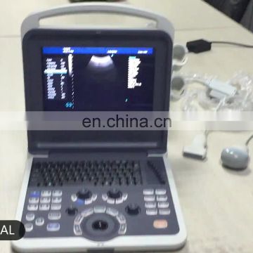 China cheapest medical Full Digital Color Doppler B Ultrasound Machine/Scanner for pregnancy with ultrasonic probe