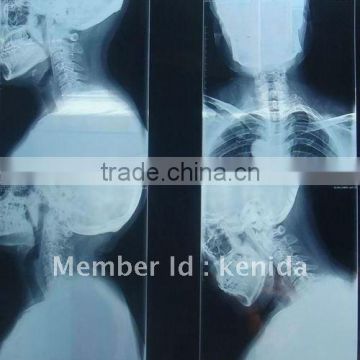 ct scan film of china medical accessories, radiography film