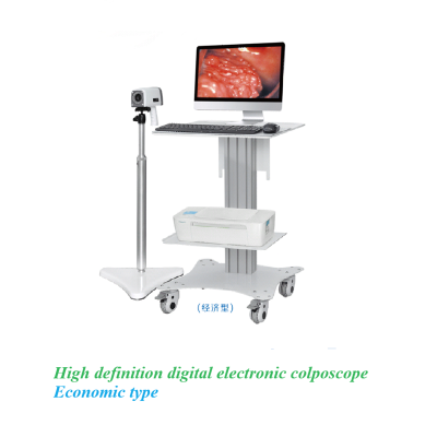 High definition digital electronic colposcope