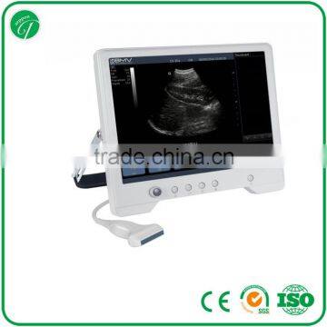 Ultrasound Machine 3d Laptop Touch Screen B-ultrasound Scanner TS20