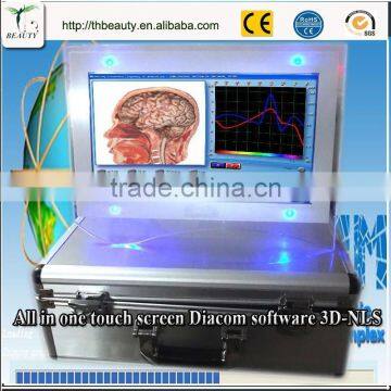 2015 Protable Computer Style All in One Rapid Diagnostic Test Device Detector Tester photo-4