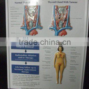 3D embossed poster printing
