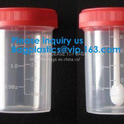 Specimen Bottle, Alcohol Spray Bottle, Nozzle, Cleaning Solution, Household, Commercial, Industrial Use photo-2