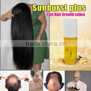 Sunburst Plus Hair Growth Lotion NEW UPGRADE 100ml