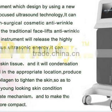 2015 Most Popular Lift Eyes&Brows Remove Crows Feet & Pouches High Intensity Focused Ultrasound Hifu photo-4