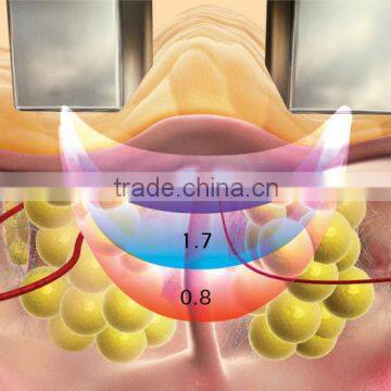 Viora Reaction for Sale photo-2