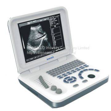 Ноутбук-тип черно-белый ультразвуковой сканер диагностического оборудования photo-2