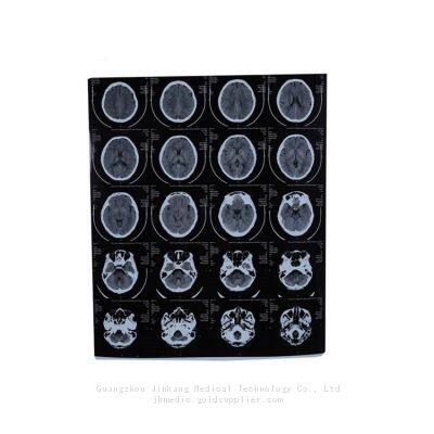 Digital X-ray Films，Dry Films, Thermal Films for Digital X-ray photo-5