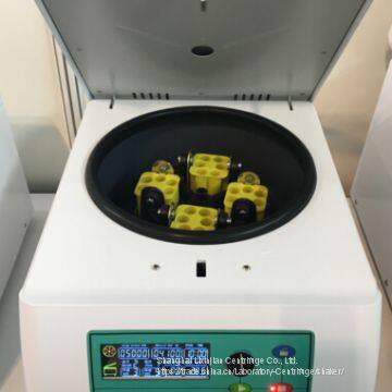 Lab Centrifuge 6,000rpm Angle Rotor Medical Centrifuge LCD Display 24 x 5m (L-600A) photo-3