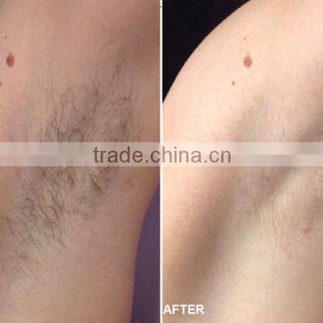 Special Design Apolomed HS-650 IPL SHR Laser Permanently Hair Removal IPL photo-6