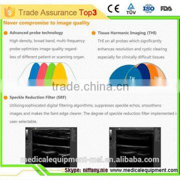 Coupon Available! Ipad Ultrasound Scanner, Touch Screen Scanner 3D Color Doppler MSLCU22-N