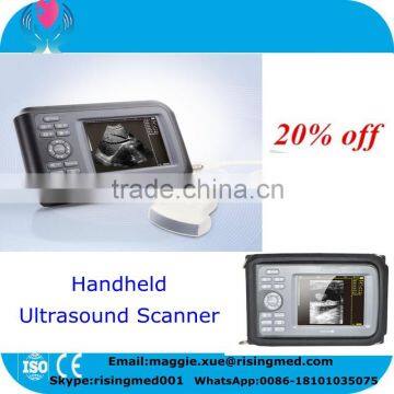 Promotion Palm Ultrasound Scanner HandScan H8 with 3.5 Mhz Convex probe 5.5 inch monitor