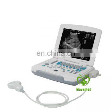 MY-A007B medical portable Full-digital beam imaging technology Laptop Ultrasound Scanner with USB type Probe