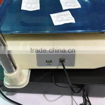 Yonzo Electronic Digital Food Scale With Printer photo-3