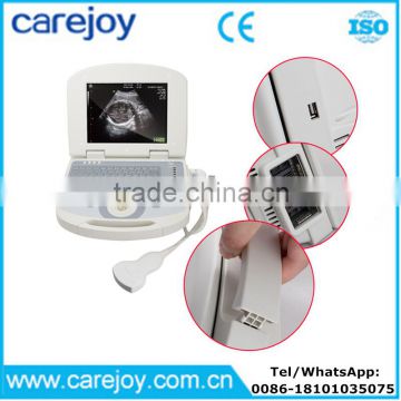 10 inch portable ultrasound scanner USG machine with 3.5Mhz convex probe for OB/GYN urology etc