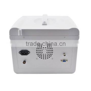 Factory Price!!CE Approved Notebook/Portable Ultrasound Scanner With 3.5Mhz Multi-frequency Convex Probe RUS-6000D photo-3