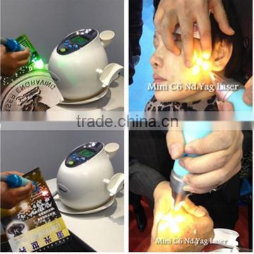 High Power Tatoo Removal Nd Yag Laser With spot Removal