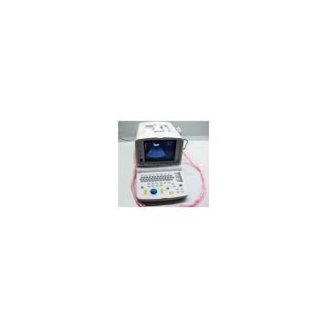 Portable Ultrasound Scanner----CE Approved Ultrasound Machine