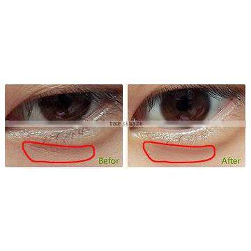 Weight Loss Best Effective Machines Cavitation Figure Shaping Body Slimming Skin Tightening Fat Melting Slimming Machine Ultrasonic Cavitation Cavi Lipo Machine photo-5