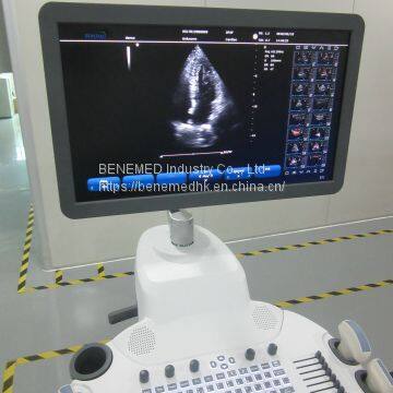 Trolly 2D Echocardiography Color Doppler Ultrasound Scanner photo-3
