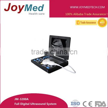 laptop 3D PC ultrasound scanner/usb ultrasound scanner