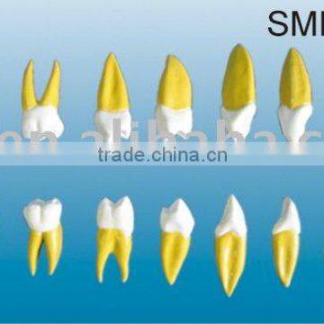 Permanent teeth amplification model