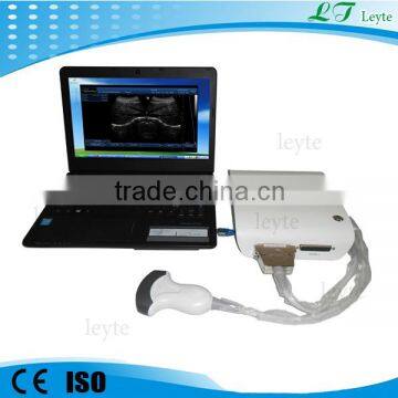 LTUB10 CE medical portable ultrasound equipment china