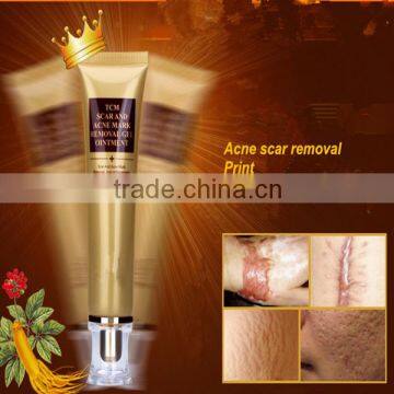 2016 New Prodcuts Best Selling Skin Care Dark Spot Whitening Acne Free gel Face Acne Scar Removal Cream