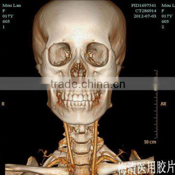 Medical dry film for hospital