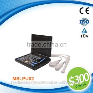 Coupon available! MSLPU02 Notebook/Laptop/Portable Echo Ultrasound with competitive price