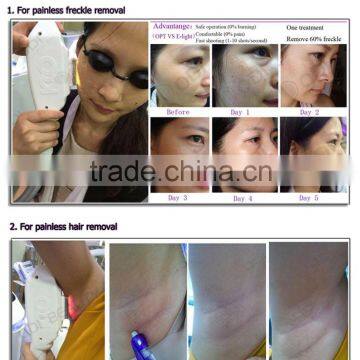 OD-E90 Multifunctional Beauty Best Hair Removing Ipl / Shr E-light photo-4